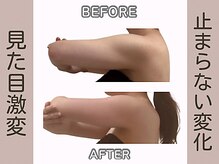 エイム(Aim)の雰囲気（短期間で結果を出す手技！10年の経験で導く理想のボディ）