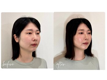 スタイルキューピット(style cupit)/メイクビフォアフター＊30代