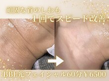 リアン