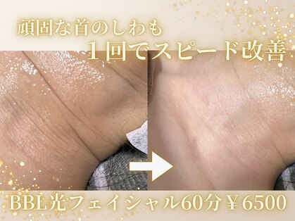 リアンの写真
