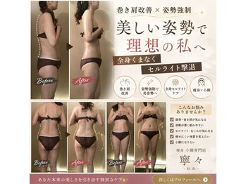 寧々/ビフォーアフター巻き肩改善