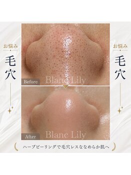 ブランリリー(Blanc Lily)の写真/薬院大通駅から徒歩4分の落ち着くサロン♪上質なエステタイムで、毛穴レスな美肌を手に入れてみませんか？