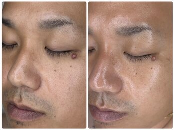 エンビ(enbi)の写真/男性歓迎の個室空間にて、清潔感UP！本格肌改善をサポートする極上のケアを◎