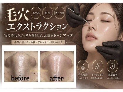 モムケア(momcare)の写真