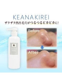 ミルトゥ(myrte)/KEANAKEREI　お鼻の黒ずみ・毛穴