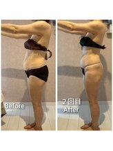 エミア(Emia)/全身痩せ×歪み改善◎120分 ２回