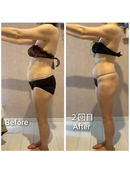 エミア(Emia)/全身痩せ×歪み改善◎120分 ２回