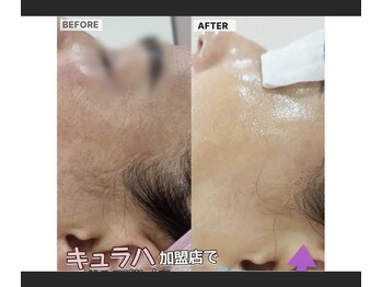 パールブルー(All Perl blue)/韓国肌管理