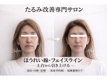 エミニナル(EMININAL)