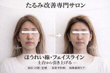 エミニナル(EMININAL)