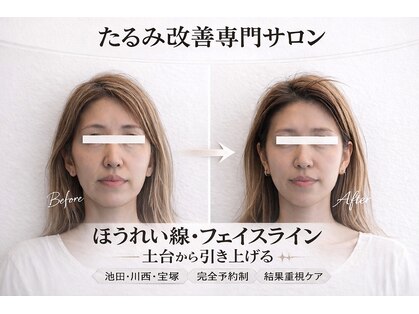 エミニナル(EMININAL)の写真