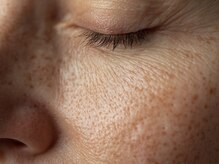 リードスラッシュ(LEAD/)の雰囲気（ 「毛穴開き・シミ・しわ、重なっていませんか？」）