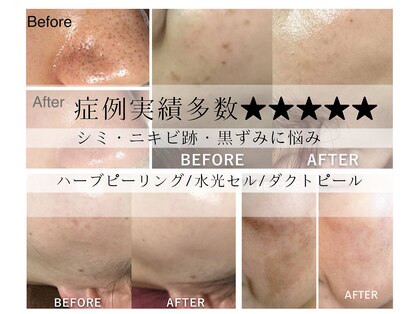 肌屋(HADA-YA)の写真