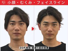 男の小顔矯正 顔ジム 錦糸町店【メンズ/小顔整体/毛穴ケア/ヘッドスパ】