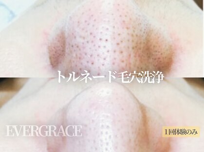 エヴァーグレース 栄店の写真