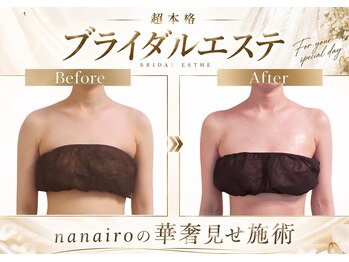 ナナイロ(nanairo)の写真/【多数の花嫁様実績】当店だけしかできない施術を。顔からボディまで超本格オーダーブライダルエステ。