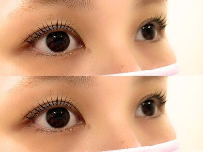 エクシアホワイトニング 西尾店の写真