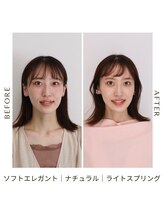 シュアリー(Surely)/トータルコースお客様事例