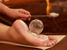 足裏カッピングで冷え性の改善に！