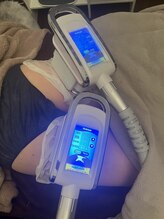 フェリシア(FELICIA)/脂肪冷却