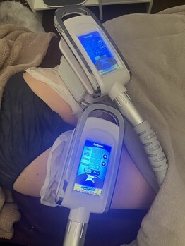 フェリシア(FELICIA)/脂肪冷却