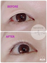 ラナ(Lana)/重たいまぶたUP↑↑