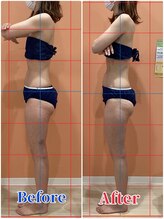 ハンズ鍼灸接骨院小牧院 美容整体ハンズ(美容整体hands)/エステ ヒップアップ