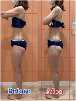 ハンズ鍼灸接骨院小牧院 美容整体ハンズ(美容整体hands)/エステ ヒップアップ