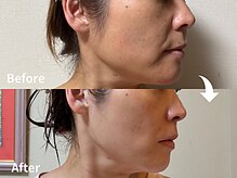 サロンドモモ(SALON de MOMO)/美肌★フェイシャルビフォアフ