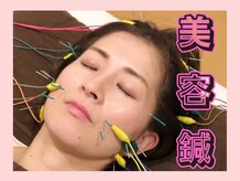 ティンクル(Twinkle)