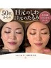 50代からの【目元のしわ・口元のたるみ】美容鍼トライアルコース