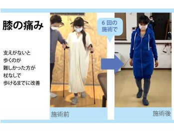 セルフケア整体 新宿店/実際のお客様◆6来店 膝の痛み