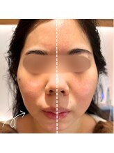 美バリ 新宿店(美BARI)/痛みの少ない！