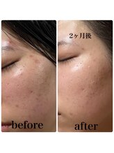 ポーラ ザ ビューティ アピタ千代田橋店(POLA THE BEAUTY)/肌育