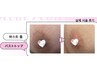 【導入記念最安値40％オフ】ローマピンク＊バストトップ