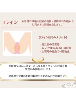 サロンアメリ 高松丸亀町店(Salon Ameri)/香川 高松 VIO脱毛 アメリ