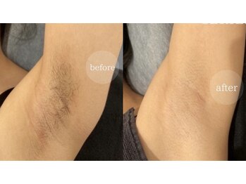 アンドエピ(&epi)/