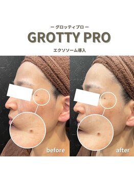 フルアナ(Hu ruana)/フェイシャルエステ