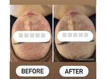 コンプレックス肌をご自身最高な肌へと導きます！