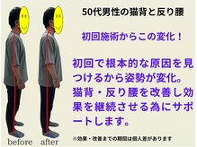 とりまる整体院 アイワイ(iy)/５０代男性が初回から姿勢変化