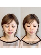 小顔矯正&美容整体サロン　Still U 渋谷/一回での変化♪