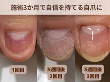 ブルームーンネイルズ(BLOOMOON.nails)/