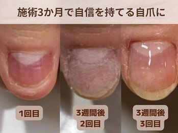 ブルームーンネイルズ(BLOOMOON.nails)/