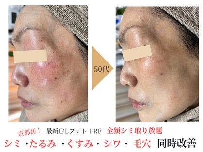 エソア(esoa)の写真