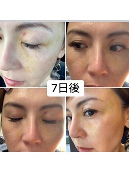 ランスソア(L'ins soi)/