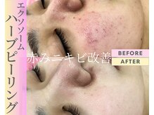 Cスキンケアクリニック 麻布店の雰囲気（【ハーブ業界最先端ハーブを使用/ハーブピーリング】肌質改善へ!）