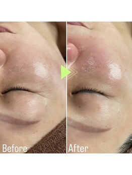 グレース(GRACE)/ラミピール　