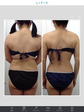 健康痩身研究所 名和店/ビフォーアフター