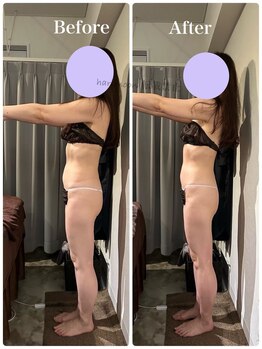 ハリムーン 仙台(harimoon)/120分美バストビフォーアフター