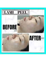 グランディールアン(GRANDIR UN)/LAMI PEEL